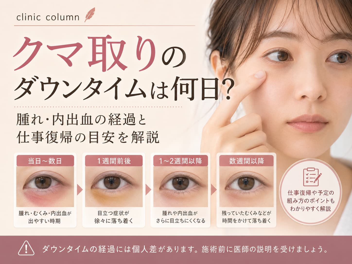 クマ取りのダウンタイムは何日？腫れ・内出血の経過と仕事復帰の目安を解説