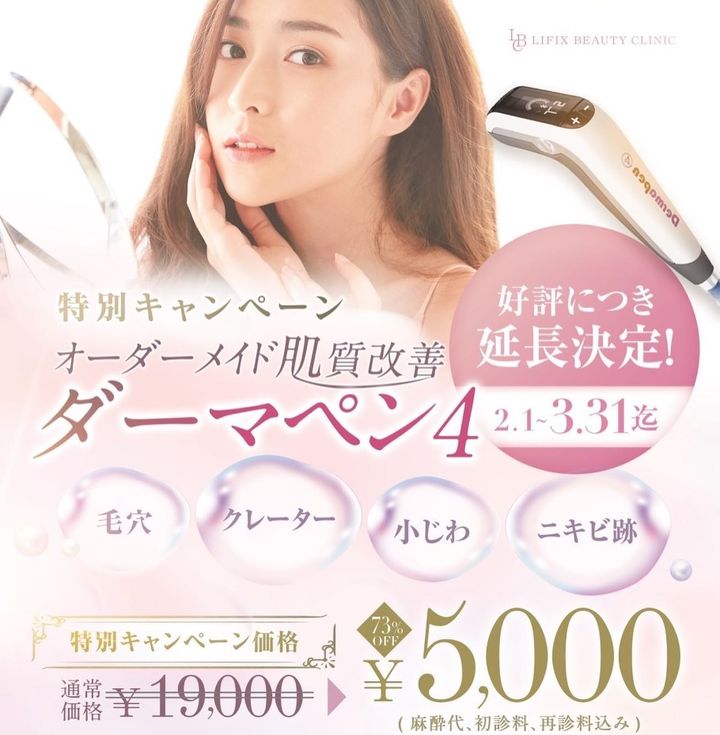【キャンペーン】大人気のダーマペン4が1回5,000円