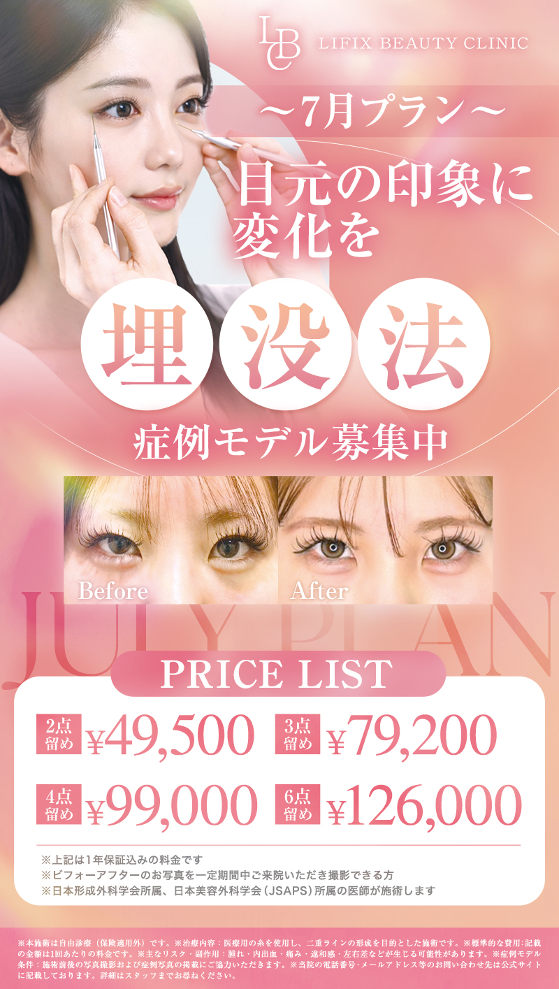 【7月プラン】埋没法のご案内