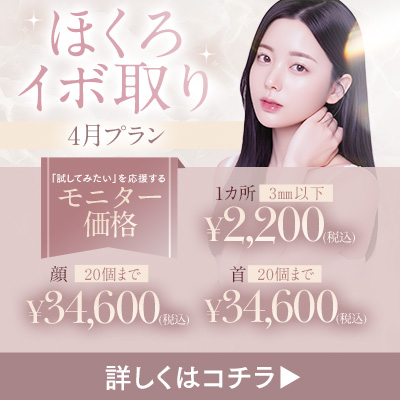 イボ取り 4月プランのご案内