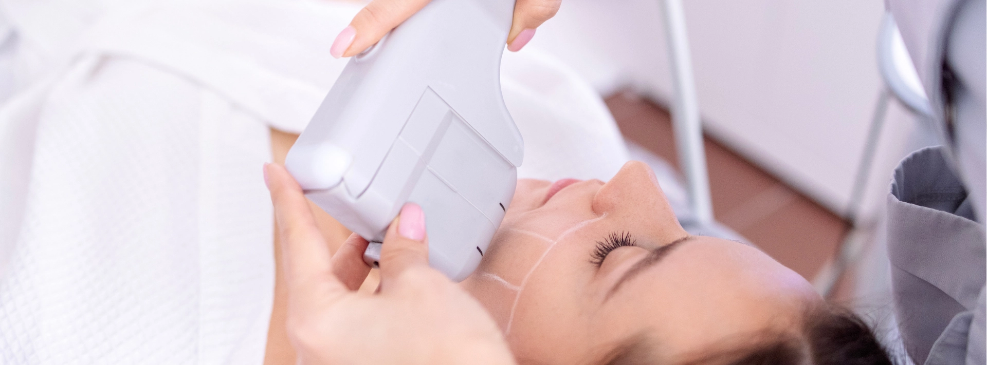 ウルトラフォーマーMPT（HIFU）